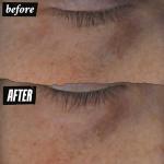 Kiehl's Vitamin C Eye Serum for Dark Circles