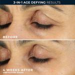 RoC Retinol Eye Cream for Dark Circles & Puffiness