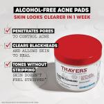 Thayers Acne Treatment Pads with Salicylic Acid