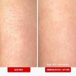 KP Bump Eraser Body Scrub with AHA