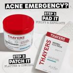 Thayers Acne Treatment Pads with Salicylic Acid