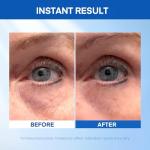 Under Eye Lift Serum for Puffiness and Wrinkles