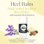Natural Heel Balm for Cracked, Dry Feet