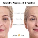 Anti-Aging Eye Cream with Retinol and Hydration