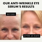 Eclat Eye Serum with Hyaluronic Acid for Brightening