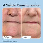 USA-made Vibriance Super C Serum: Hydrates, Firms, Lifts