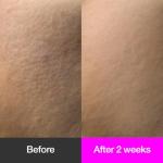 Black Cherry Pore Tightening Cream for Smooth Skin