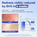 Winner Disposable Face Towels | 100% USA Cotton Face Towelettes, Super Soft & Thick Face Cloths for Sensitive Skin, Makeup Remover Dry Wipes, Face Drying Towels for Skin Care, 165 Count, 3 Pack