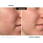 Kate Somerville ExfoliKate Intensive Scrub for Pores