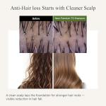 Premium TS Korean Anti-Hair Loss Shampoo 500g