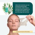 BioZyme-Enzyme Peel-Chemical Peel Results Without The Chemicals. Contains No Glycolic Or Lactic Acid, It Doesn’t Need Any-It’s A Powerful Exfoliator Using Only Natural Ingredients-For Face And Body.