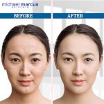 Michael Marcus Exfoliating Enzyme Peel - Papaya, Pineapple & Pumpkin Enzymes - Hydrating Sodium Hyaluronate & Soothing Aloe Targets Fine Lines & Wrinkles - Plant Based for Smoother Skin (1.7oz Jar)