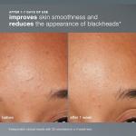 Dermalogica Daily Microfoliant Exfoliator Powder