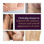 Mederma Advanced Scar Gel, Treats Old and New Scars, Reduces the Appearance of Scars from Acne, Stitches, Burns and More, 50 Grams