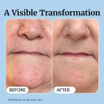 USA-made Vibriance Super C Serum: Hydrates, Firms, Lifts