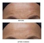 Dr. Denese Firming Facial Pads with Glycolic Acid