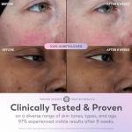 Olay Super Serum with Niacinamide and Vitamin C