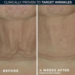 RoC Retinol Firming Serum Stick & Eye Cream