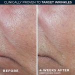 RoC Retinol Firming Serum Stick & Eye Cream