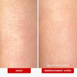 KP Bump Eraser Exfoliating Body Scrub 8 oz