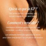 KP Bump Eraser Exfoliating Body Scrub 8 oz