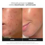 Skin Perfecting BHA Liquid Exfoliant – Travel Size