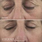 DRMTLGY Brightening Eye Masks - Caffeine Hyaluronic Acid Solution