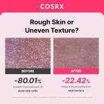 COSRX AHA BHA PHA LHA 35% Peel 1.01 fl. oz / 30 ml, Chemical Exfoliating Peeling Gel for Dull, Rough, Oily Skin with Clogged Pored & Dead Skin Cells, Highly Concentrated, Korean Skincare, Paraben Free