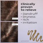 KAMEDIS Leave-On Scalp Lotion for Dandruff Relief