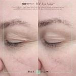 BIOEFFECT EGF Eye Serum with De-Puffer Rollerball