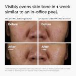 The Ordinary AHA 30% + BHA 2% Peeling Solution