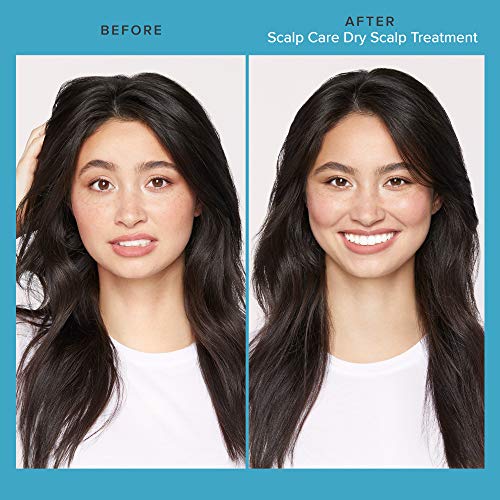 Dry Scalp Treatment for Healthy Hair Care
