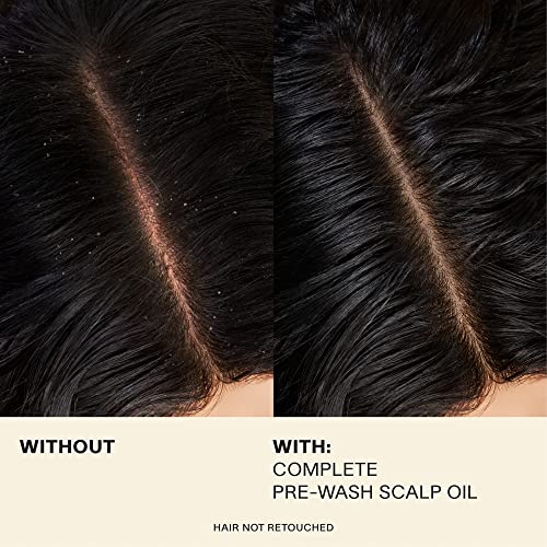 Revitalizing Rosemary Hair and Scalp Treatment Oil