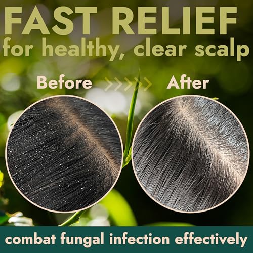 Tea Tree Scalp Scrub for Itchy Scalp Relief