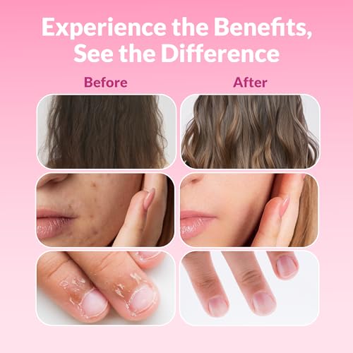 Biotin Hair, Skin, and Nails Supplement - 60 Capsules