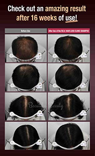 RGIII Red Ginseng Hair Loss Prevention Set