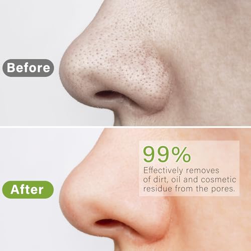 Weeping Willow Oil Co - Clay Mask, Deep Pore Cleaner with Tomato, Moisturizing & Exfoliation Facial Masks Cleanse, Skin Care for Women