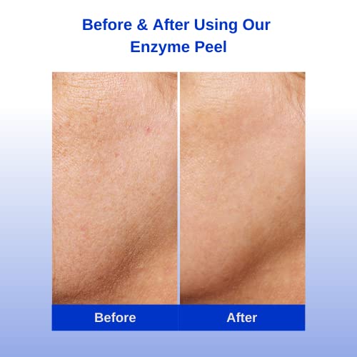 Michael Marcus Exfoliating Enzyme Peel - Papaya, Pineapple & Pumpkin Enzymes - Hydrating Sodium Hyaluronate & Soothing Aloe Targets Fine Lines & Wrinkles - Plant Based for Smoother Skin (1.7oz Jar)