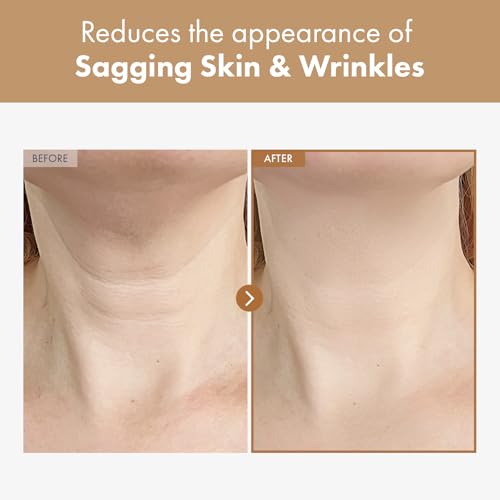 NATUREONE Intensive Neck Cream, Ultimate Skin Care Solution with Hyaluronic Acid, Collagen and Shea Butter, Neck Firming and Tightening, 50g, 1.76 oz.