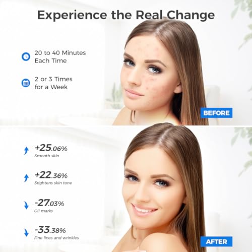 Red Light Therapy for Face，Led Face Mask Light Therapy with Spray Function, 7 in 1 Led Mask Light Therapy Beauty Equipment for Skin Care