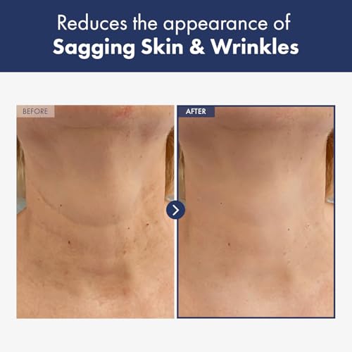 NATUREKIND INTENSE LIFTING NECK CREAM, Advanced Skin Care with Hyaluronic Acid, Collagen and Shea Butter for Neck Firming and Tightening, 50g, 1.76 oz.