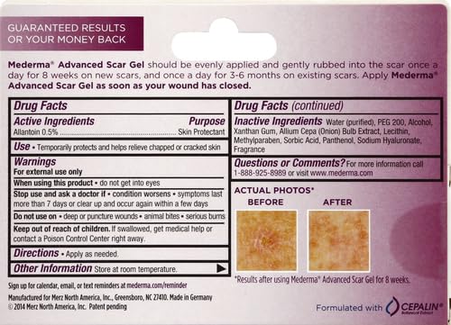 Mederma Advanced Scar Gel - 1x Daily: Use less, save more - Reduces the Appearance of Old & New Scars - #1 Doctor & Pharmacist Recommended Brand for Scars - 0.7 ounce, 0.7 Ounce