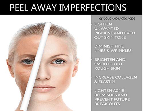 Planet Eden 40% Glycolic Acid Chemical Peel Kit with Fan Brush - Peel for Wrinkles, Enlarged Pores, Dark marks, Sun Damage