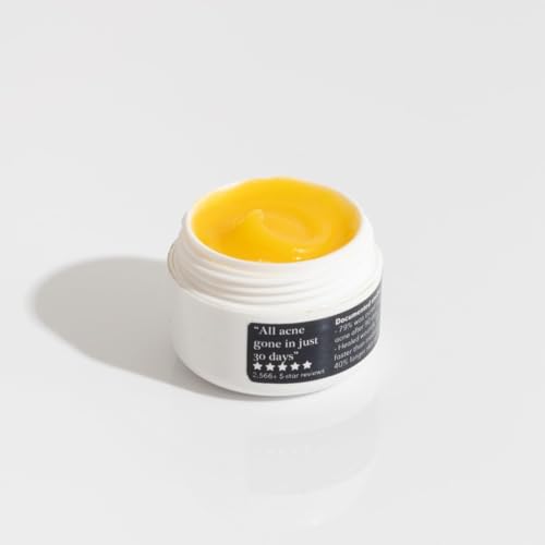 Norse Organics Acne & Redness Killer, Norse Organics Acne Balm, Acne Remove Skin Care Set, Ultra-Performance Skincare, Acne Clearing Cream for Man (1pc) q