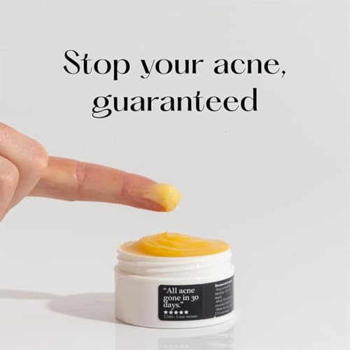 Norse Organics Acne & Redness Killer, Norse Organics Acne Balm, Acne Remove Skin Care Set, Ultra-Performance Skincare, Acne Clearing Cream for Man (1pc)