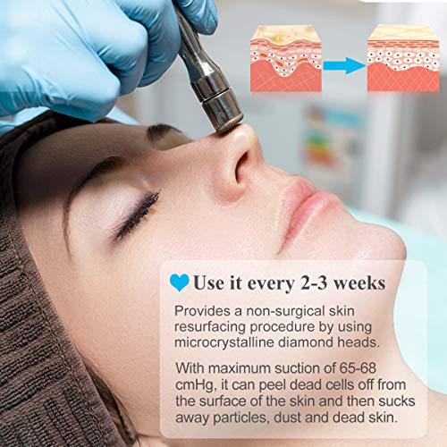 Upgraded Diamond Microdermabrasion Machine, Mcwdoit 65-68cmHg Suction Power Professional Dermabrasion for Skin Peeling Rejuvenation Lifting Tightening Beauty Device