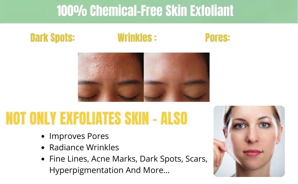 BioZyme-Enzyme Peel-Chemical Peel Results Without The Chemicals. Contains No Glycolic Or Lactic Acid, It Doesn’t Need Any-It’s A Powerful Exfoliator Using Only Natural Ingredients-For Face And Body.