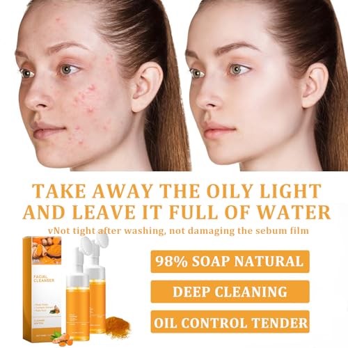 Turmeric Facial Cleanser Set, Turmeric Face Wash, Foaming Facial Cleanser and Lemon Turmeric Soap Bar, Face Skincare Deep Cleaning Moisturizing for All Skin