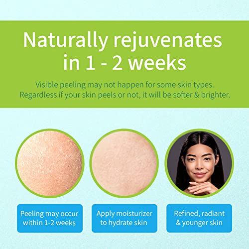 Ebanel 30% AHA 2% BHA Chemical Peel Exfoliant Gel, Face Peel with Glycolic Acid, Salicylic Acid, Lactic Acid, Green Tea, Chamomile for Acne Scars, Dark Spots, Wrinkles, Fine Lines