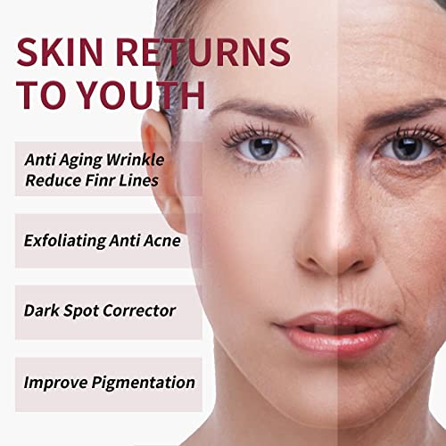 AHA 30% + BHA 2% Peeling Solution Exfoliating AHA 30% BHA 2% Peeling Solution Chemical Peel for Face BHA AHA Mask Red Peel BHA Liquid Exfoliant BHA Peeling Solution 1Floz